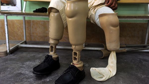 Według raportu, w biedniejszych krajach bardziej potrzebne okazują się jednorazowe igły i protezy nóg