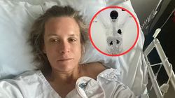 Nigdy nie paliła. Rak płuc dał bardzo nietypowy objaw