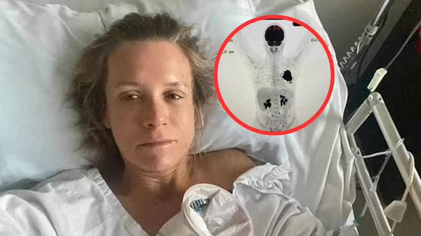 Nie paliła, ale zachorowała na raka płuc. Diagnoza była kompletnym szokiem