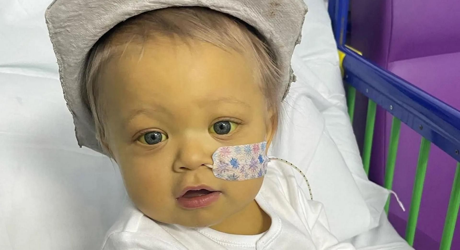 Nawet białka jej oczu zrobiły się żółte