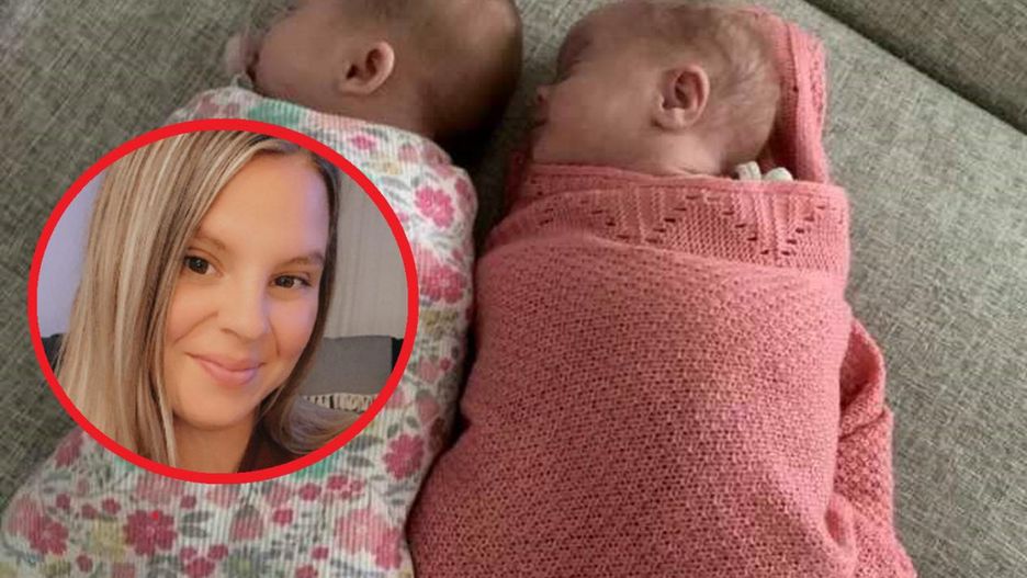 Bliźniaczki urodziły się z zespołem Downa