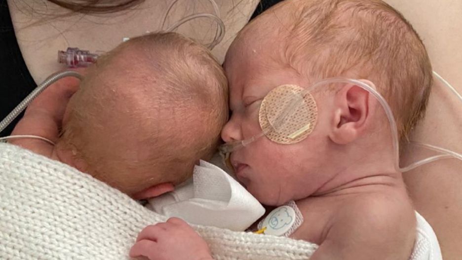 Lekarze nie sądzili, że mogą przeżyć oba płody