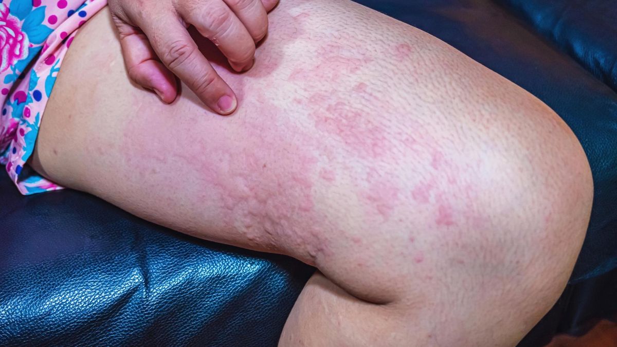 Lawinowy wzrost zakażeń. Poziom najwyższy od ponad 25 lat