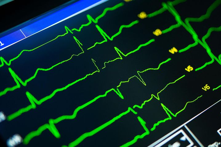 Interpretacja badania EKG serca