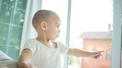 Łysienie u dzieci - przyczyny, rodzaje łysienia, leczenie