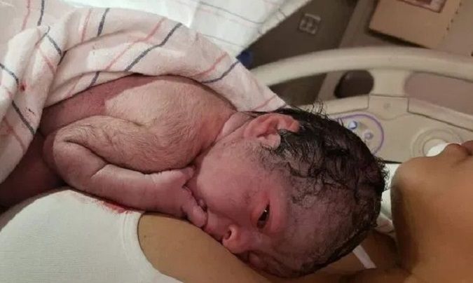 Owłosiony noworodek. Rodzice byli w szoku, gdy zobaczyli, że całe ciało malucha pokrywają gęste czarne włoski