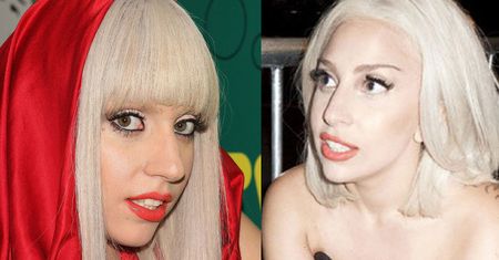 "Gaga miała KILKA OPERACJI PLASTYCZNYCH"