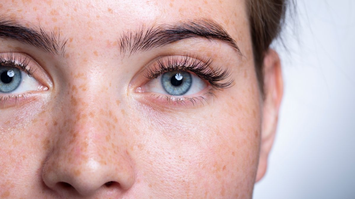 Błona przedsiatkówkowa jest patologiczną zmianą zlokalizowaną przed siatkówką oka.