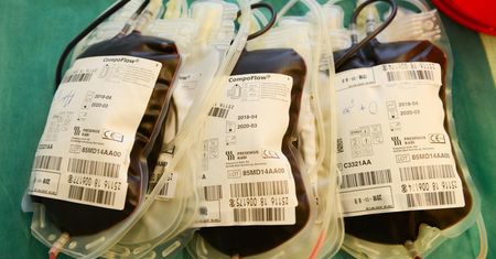 Koronawirus może niszczyć nerki. "Ostra niewydolność nerek może dotyczyć do 10 proc. pacjentów, którzy chorują na COVID-19"