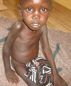 Pierwsze, głodujące dzieci otrzymały pomoc z Polski. Śmierć grozi milionom