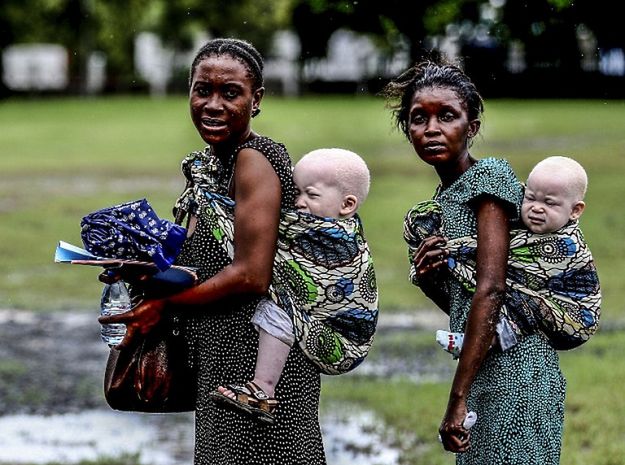 Tanzania chce chronić albinosów, zatrzymano ponad 200 czarowników