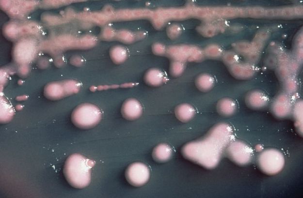 Superbakteria znów atakuje? Sanepid uspokaja, lekarze apelują: czas ogłosić epidemię