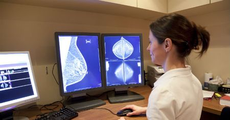 Kobiety bezpłatnie mogą skorzystać z konsultacji i mammografii w Katowicach