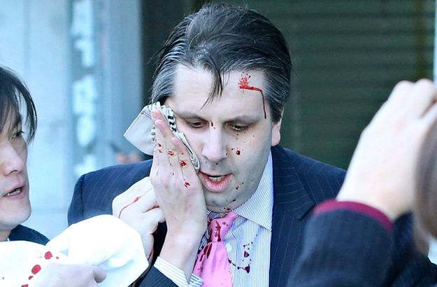 Mark Lippert tuż po ataku