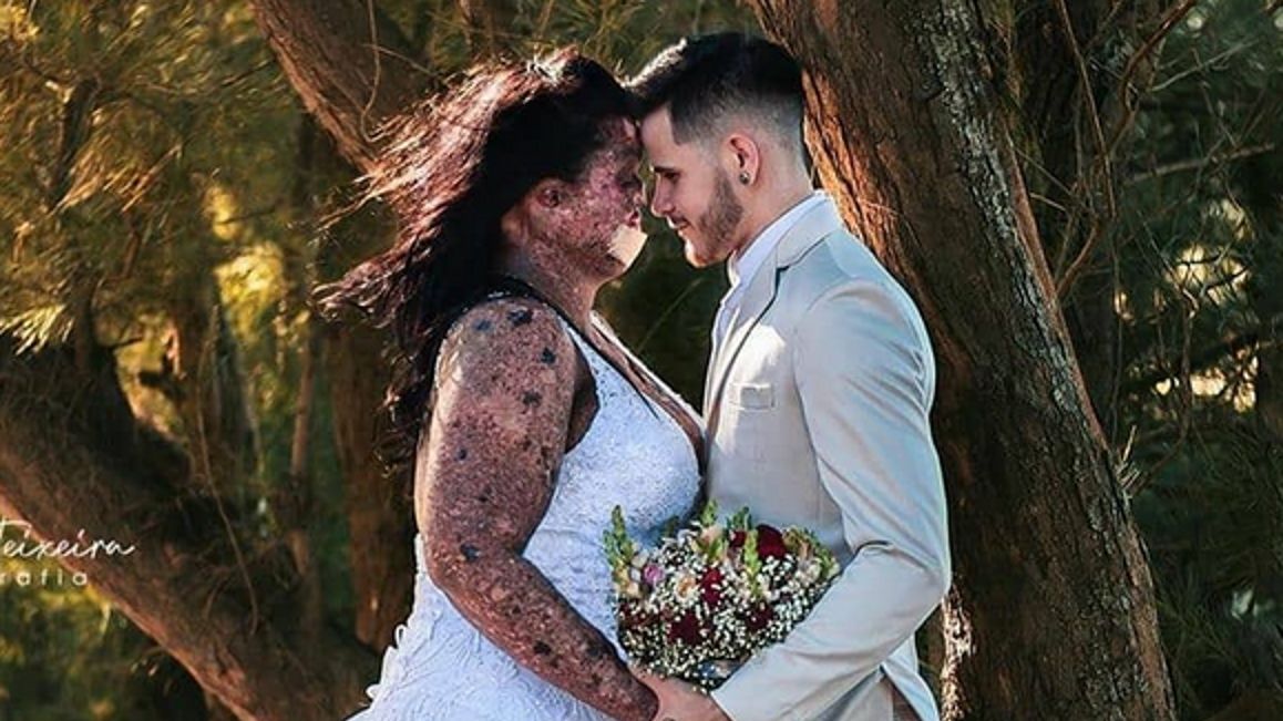 Mówią na nią potwór albo zombie.Doczekała się córeczki