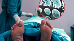 Polska w ogonie Europy pod względem transplantacji. Lekarze wskazują główne powody