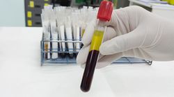 Surowica - co to jest? Surowica krwi, lipemiczna, odpornościowa 