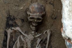W Poznaniu znaleziono szkielet z XVII w. ze śladami trepanacji czaszki