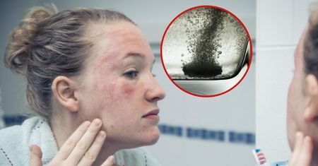 Stosujesz "wapno" na objawy alergii? Farmaceutka nie ma dobrych wieści