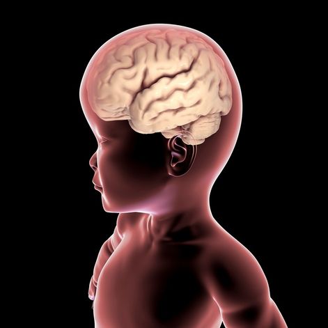 Choroba Canavan atakuje układ nerwowy dziecko, stopniowo niszcząc mózg