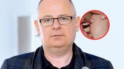 Generuje nawet 90 proc. przypadków raka płuc. Te objawy są widoczne gołym okiem