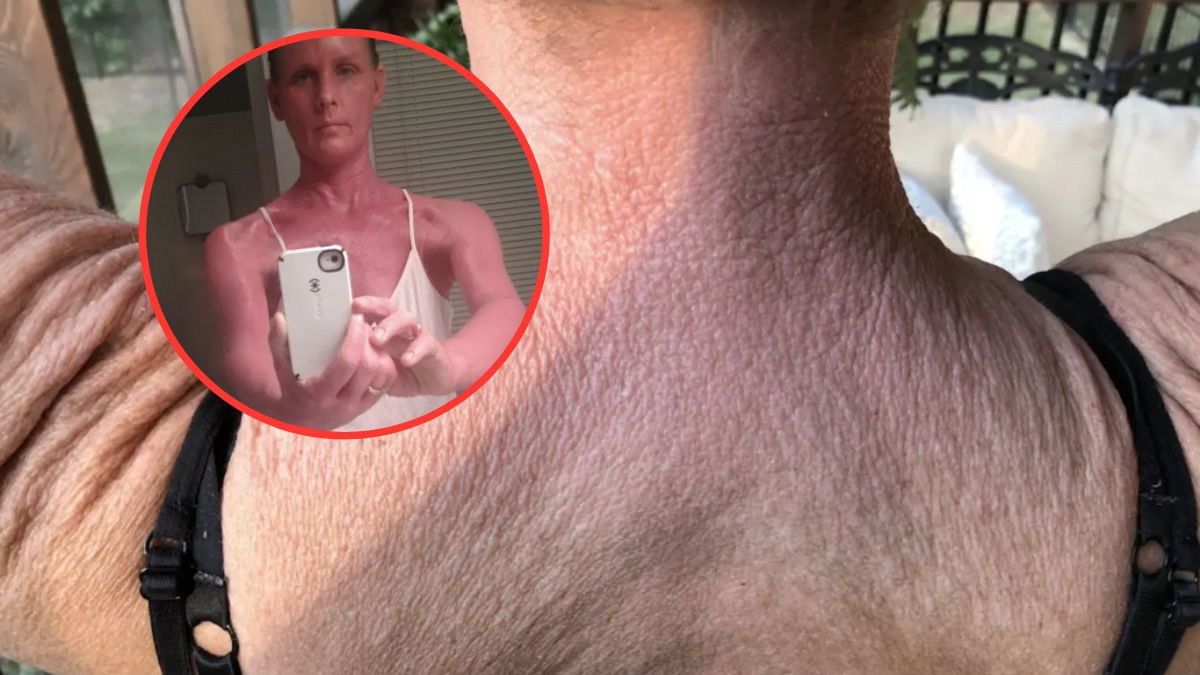 Odstawiła sterydy. To doprowadziło do powikłań