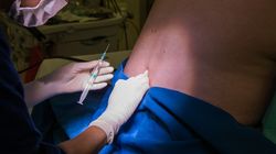 Znieczulenie w kręgosłup - podpajęczynówkowe, zewnątrzoponowe