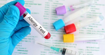 Testy alergiczne z krwi - przebieg badania, wady i zalety