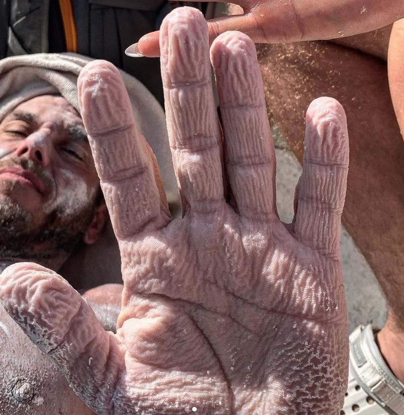 Chciał pobić rekord. Pokazał, jak wygląda teraz jego skóra