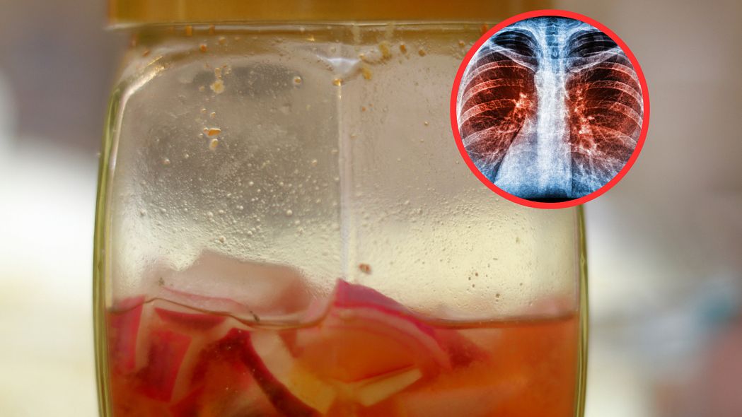 Mikstura detoksykująca dla palaczy. Oczyści płuca i zadba o układ oddechowy