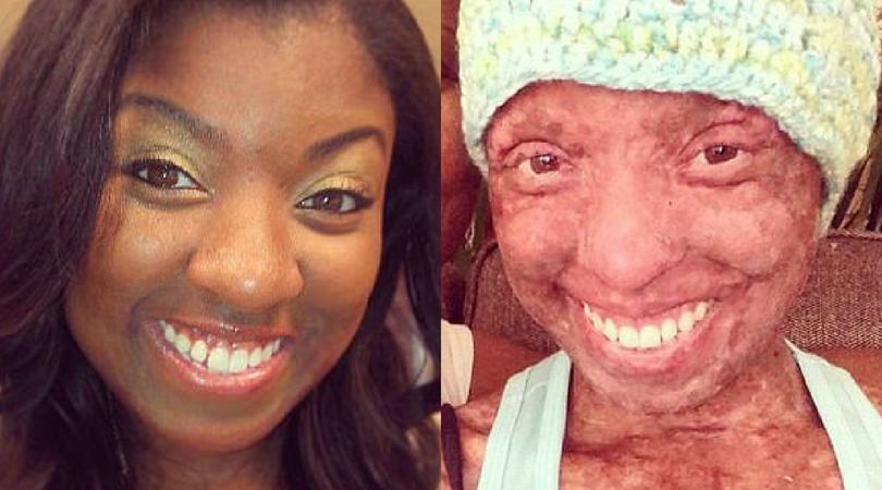 Khaliah przed i po chorobie/(Facebook.com)