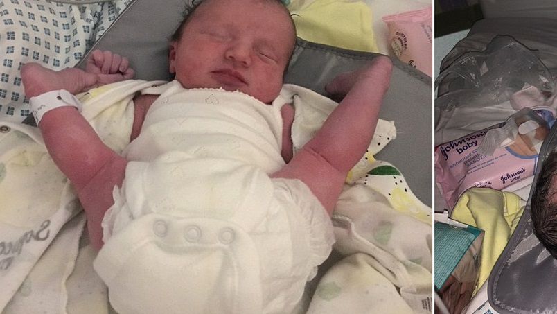 Mała Willow przyszła na świat w bardzo dziwnej pozycji