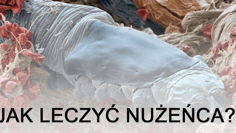 Jak leczyć nużeńca? Poznaj sprawdzone metody