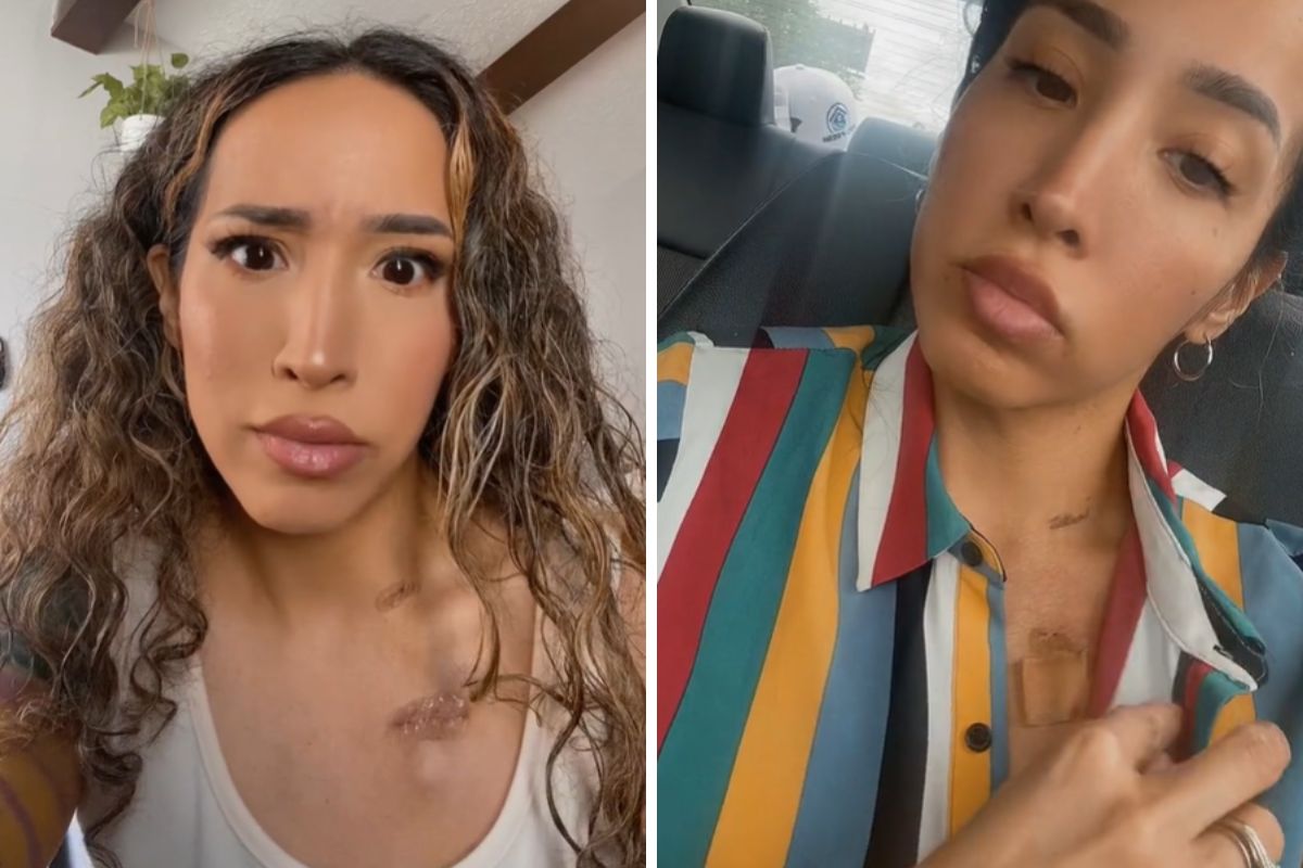 Alyssa była skrajnie zmęczona i miała zgagę