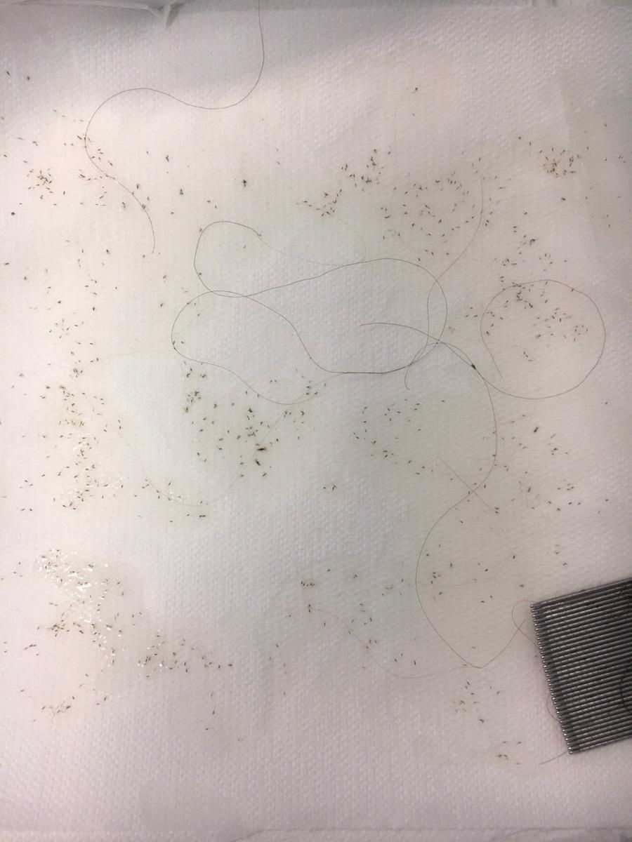 Wyczesane z włosów gnidy