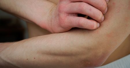 Suchość skóry – przyczyny i leczenie