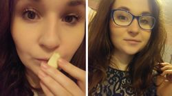 Opryszczka kontra czosnek - czy warto leczyć domowymi metodami?