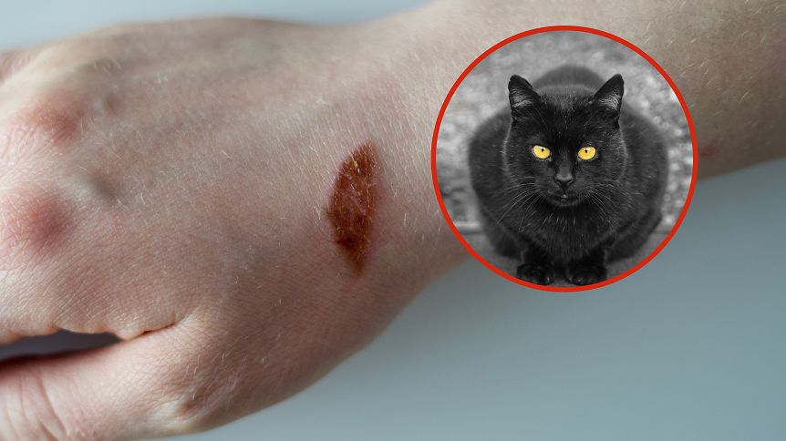 Groźny patogen dotarł do Europy. Źródłem zakażenia był kot z Brazylii