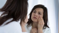 Problemy skórne a funkcjonowanie w społeczeństwie