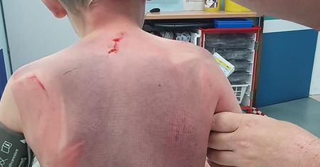 Tragedia w jacuzzi. Chłopiec został wessany przez filtr