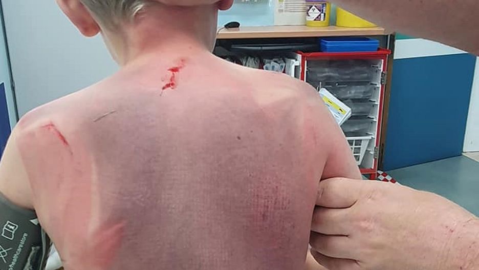 Tragedia w jacuzzi. Chłopiec został wessany przez filtr