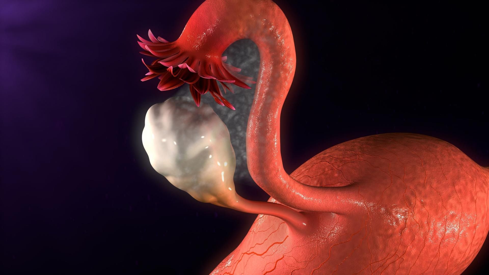 Jedną z przyczyn wystąpienia cukrzycy w ciąży może być zespół policystycznych jajników