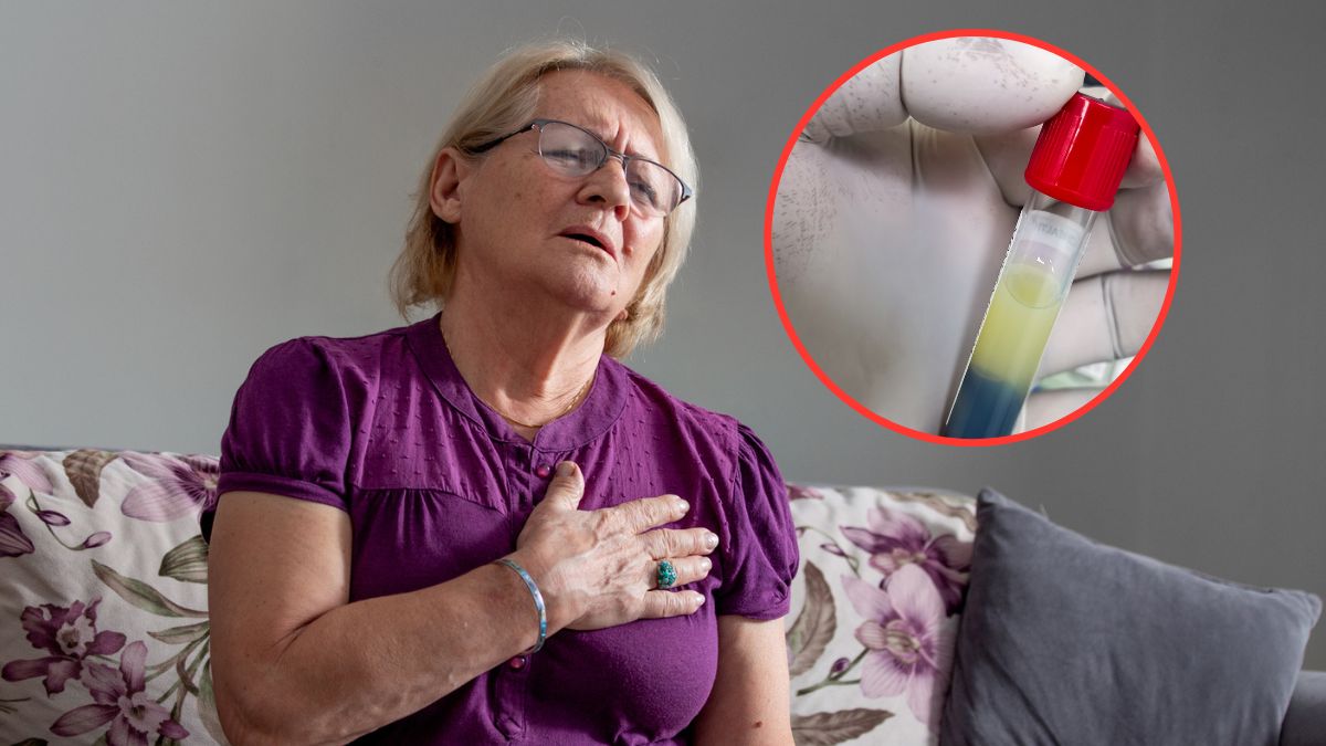 Wysokie stężenie cholesterolu zwiększa ryzyko zawału serca i udaru mózgu