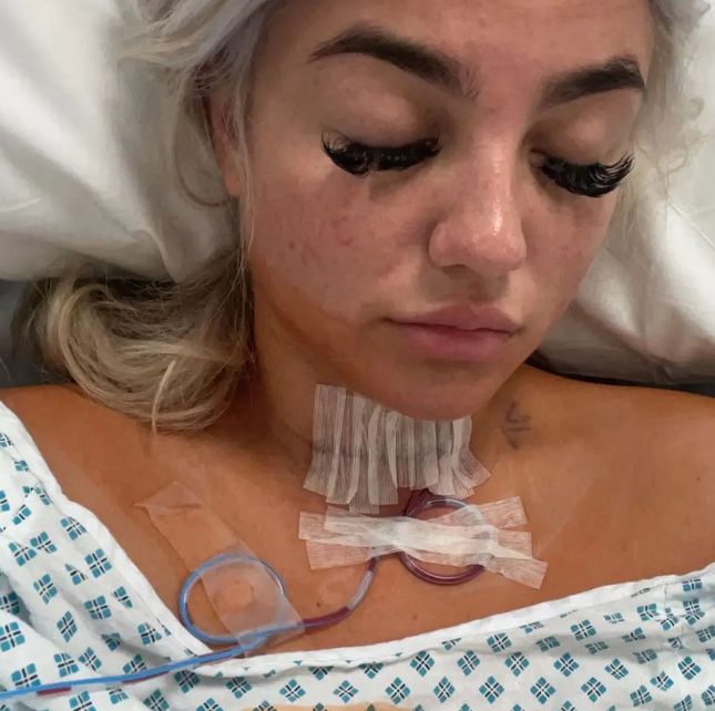 21-latka musiała przejść operację usunięcia tarczycy