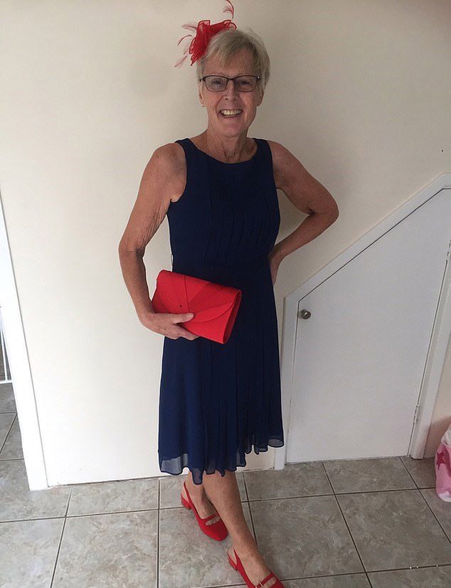 Kobieta dużo schudła z powodu raka trzustki