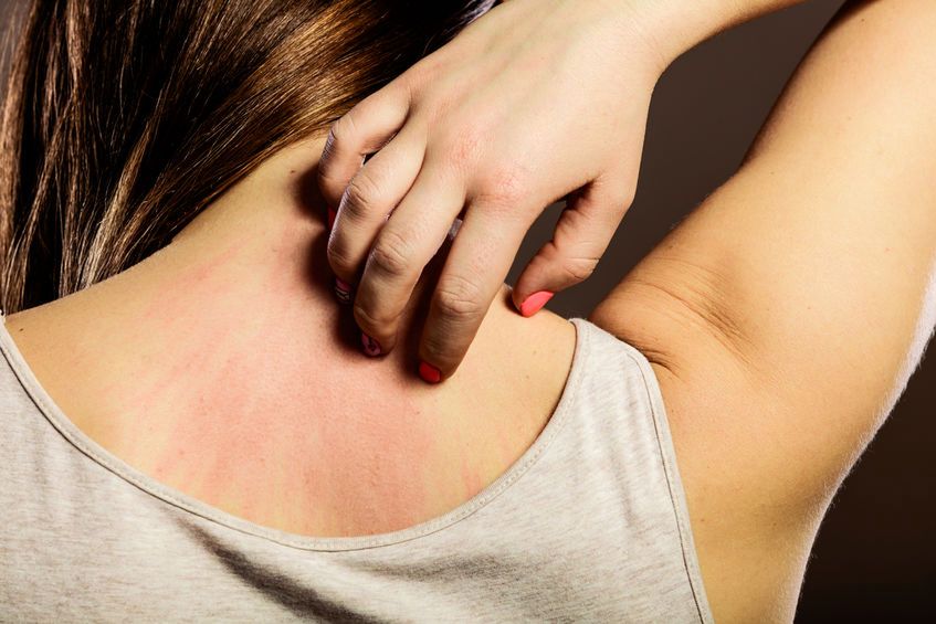 Swędzenie skóry może być objawem chorób nerek