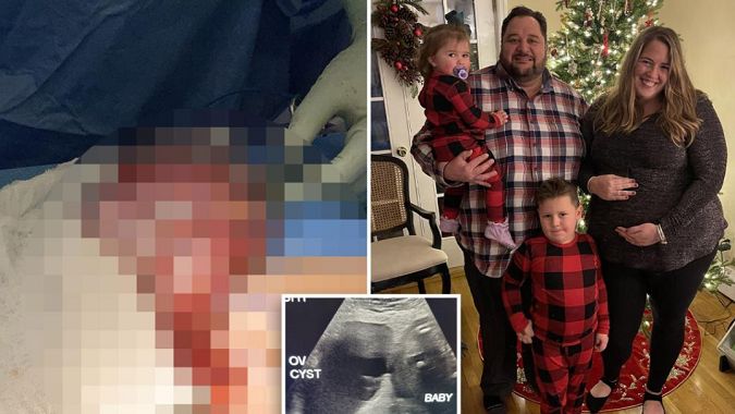 W ciążowym brzuchu nosiła nie tylko dziecko. Rosła szybciej niż maluch!