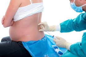 Prawo do znieczulenia podczas porodu - co powinna wiedzieć ciężarna?