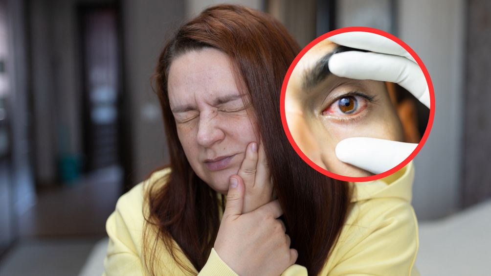 Plaga zapaleń spojówek. Nie ignoruj, bo zakażenie może uszkodzić wzrok