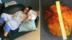 Mąż myślał, że jest opętana. Miała zapalenie mózgu 